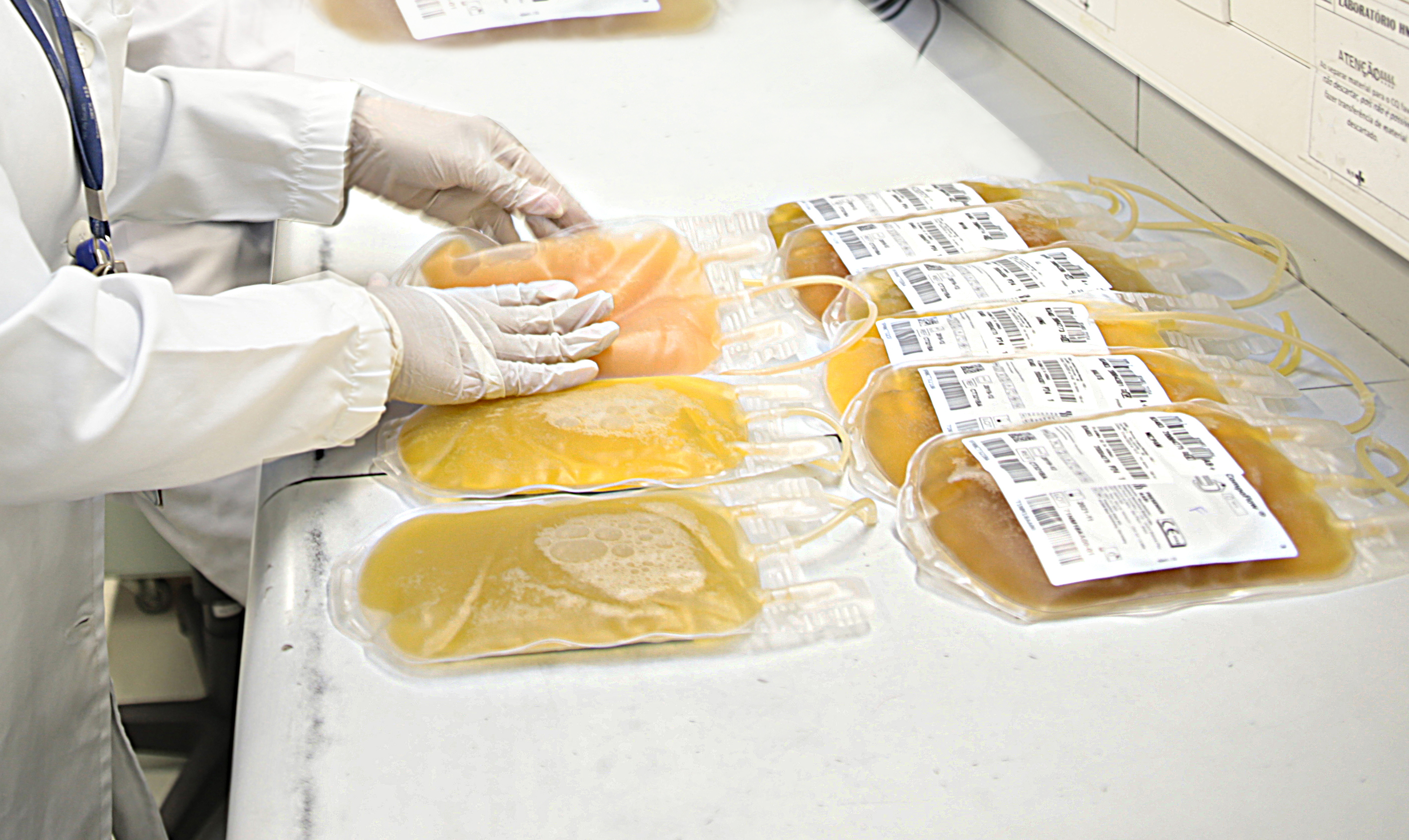 Governo de Minas amplia plasmaférese e fortalece o cuidado contra rejeição de órgãos transplantados